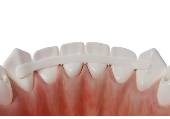 нити для шинирования SFM