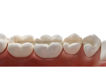 нити для шинирования и микропротезирования SFU