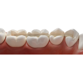 нити для шинирования и микропротезирования SFU